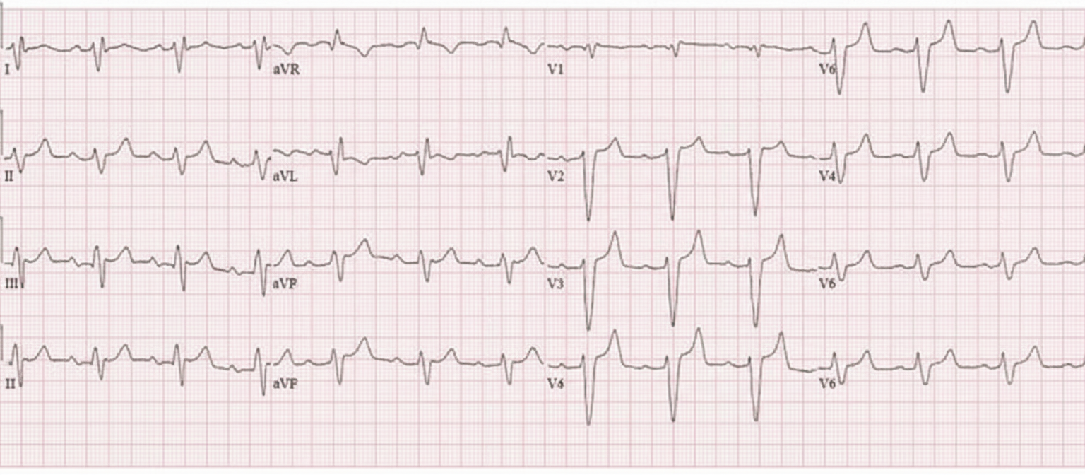 Image for question 589