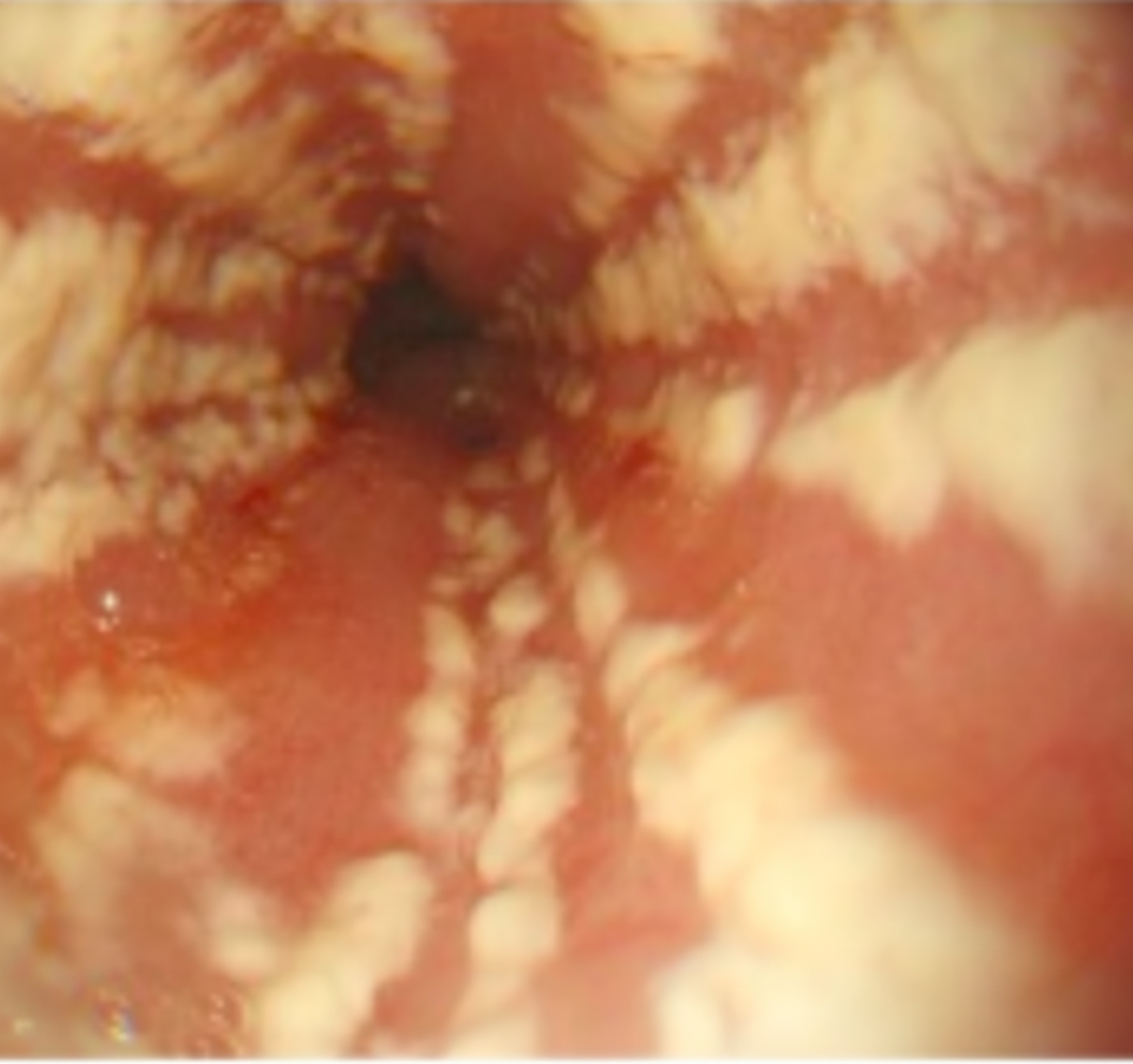 Image for question 731