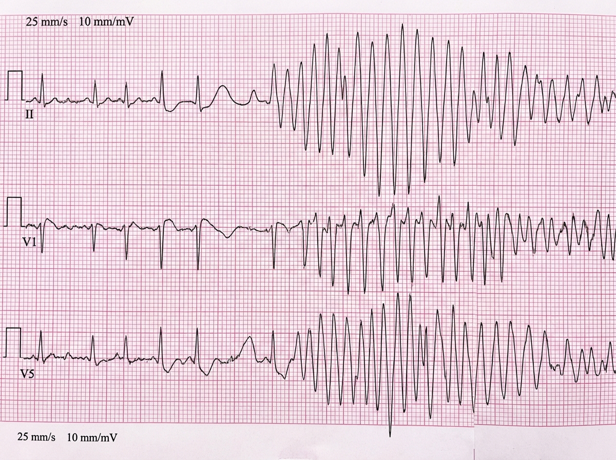 Image for question 35