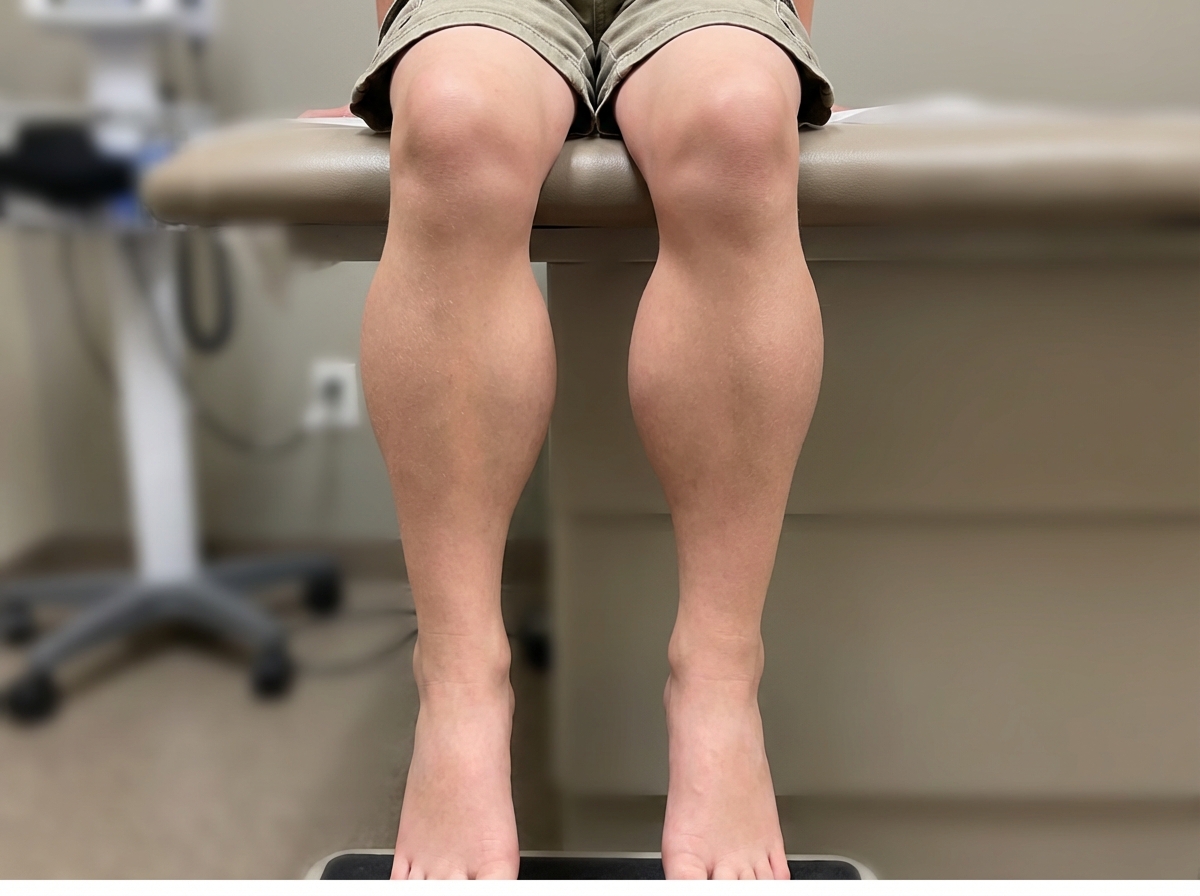 Image for question 111