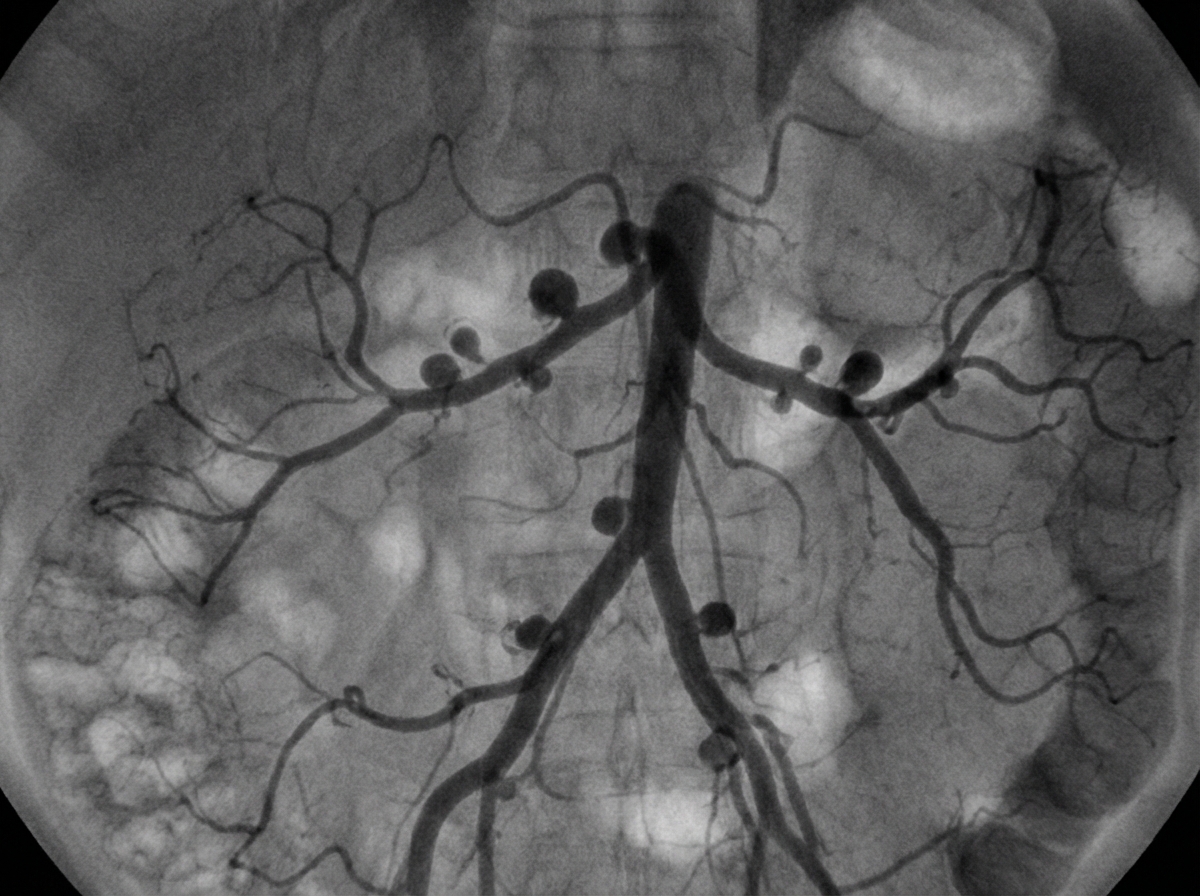 Image for question 85