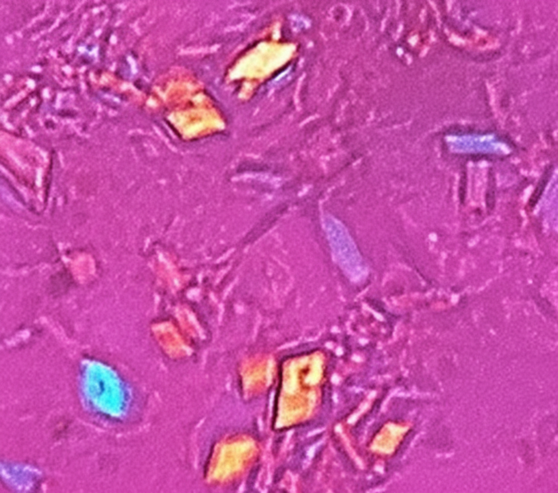 Image for question 497