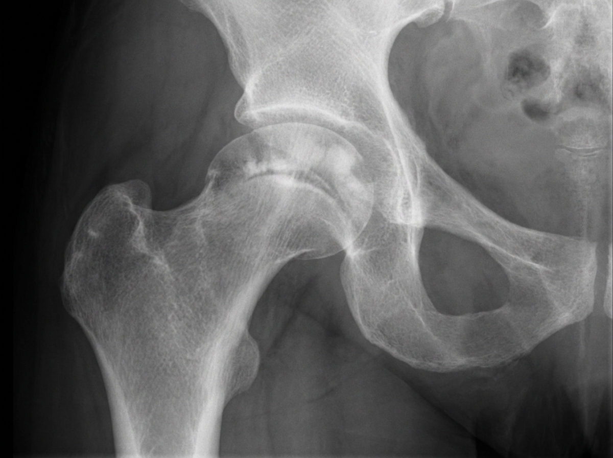 Image for question 550