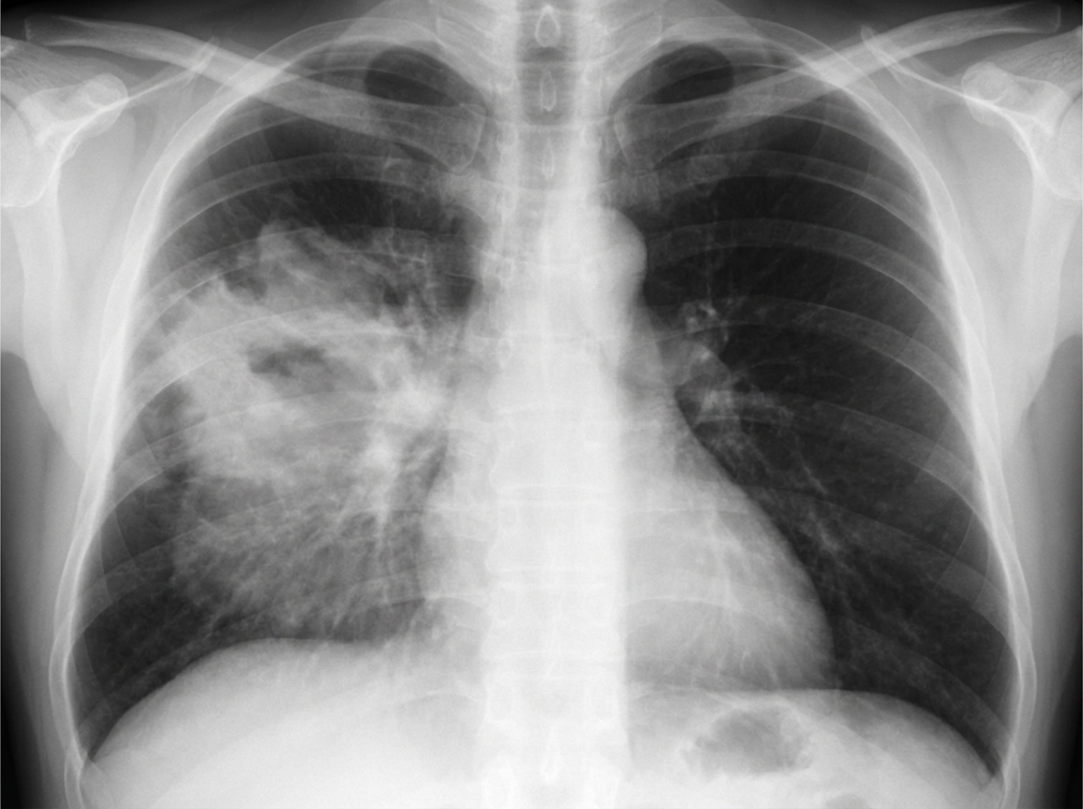 Image for question 164