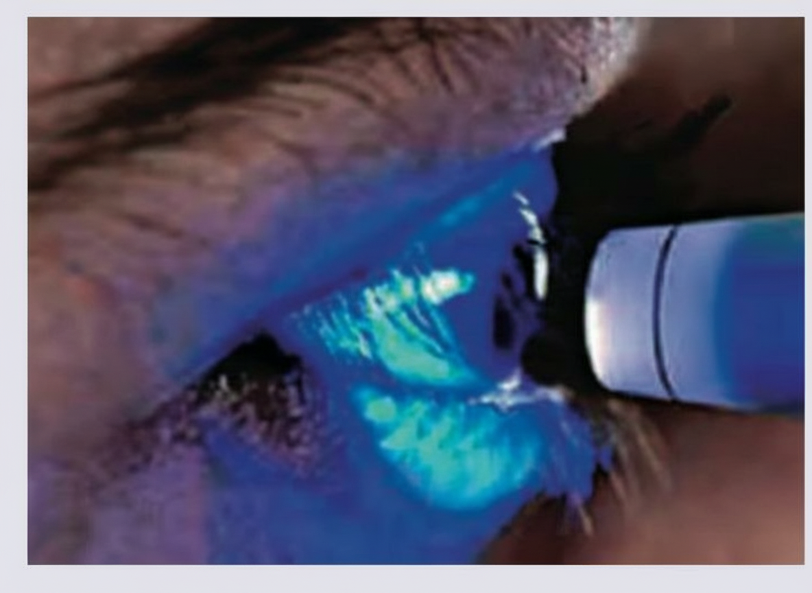 Image for question 554