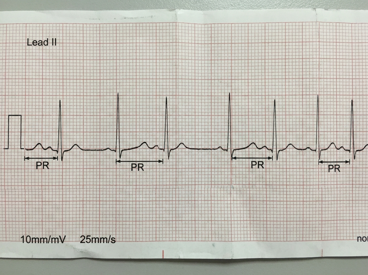 Image for question 824