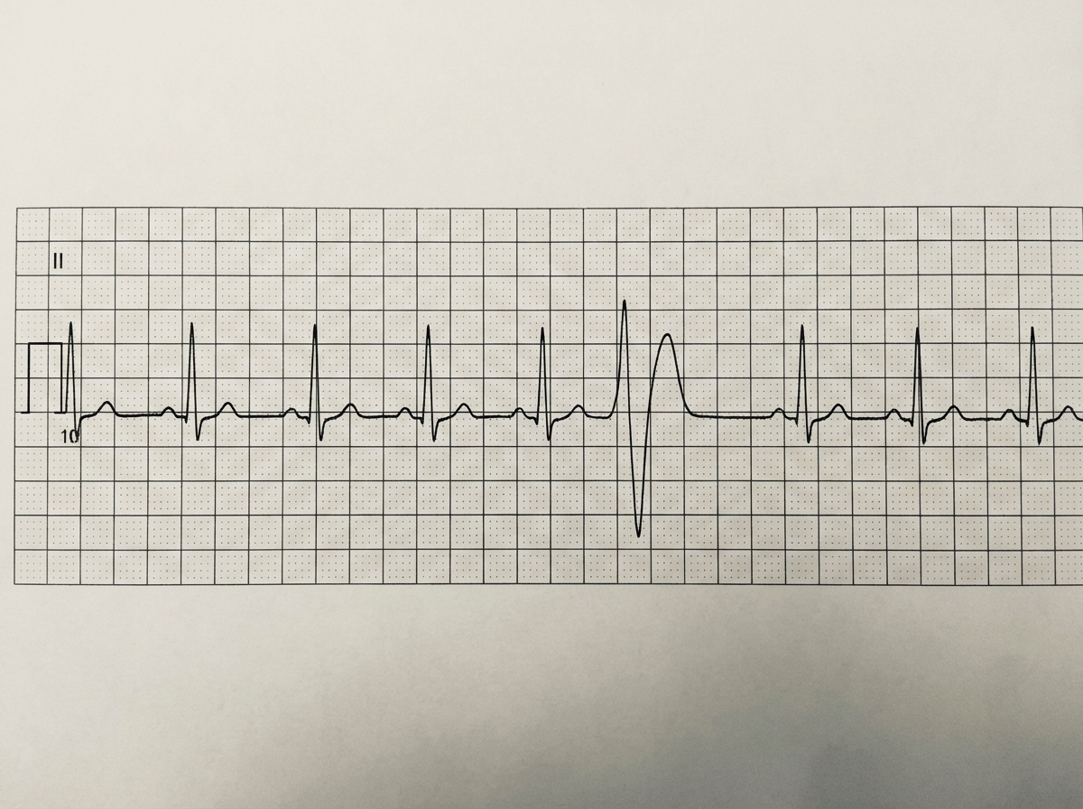 Image for question 907