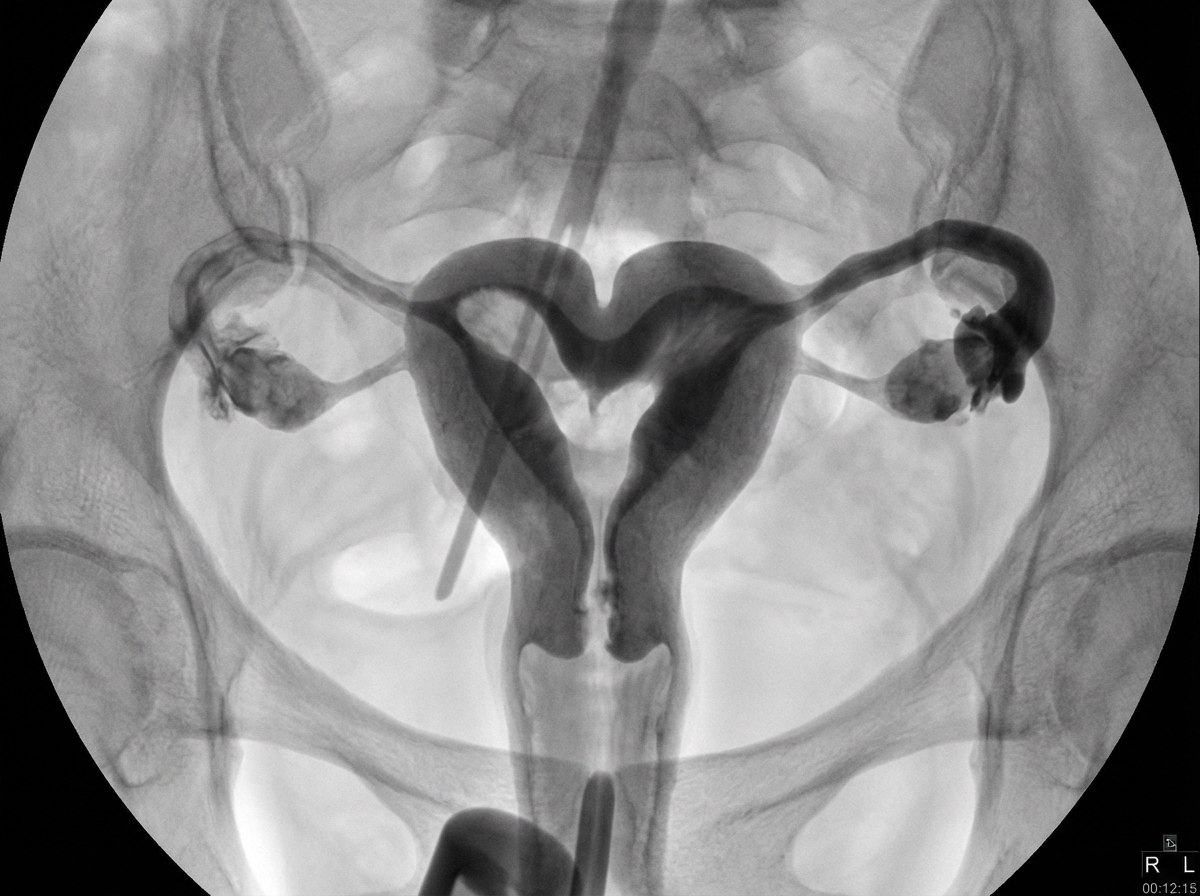 Image for question 351