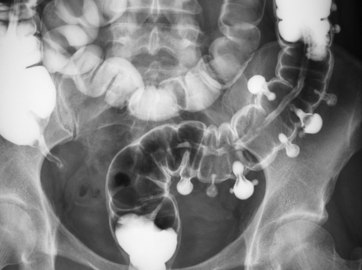 Image for question 2