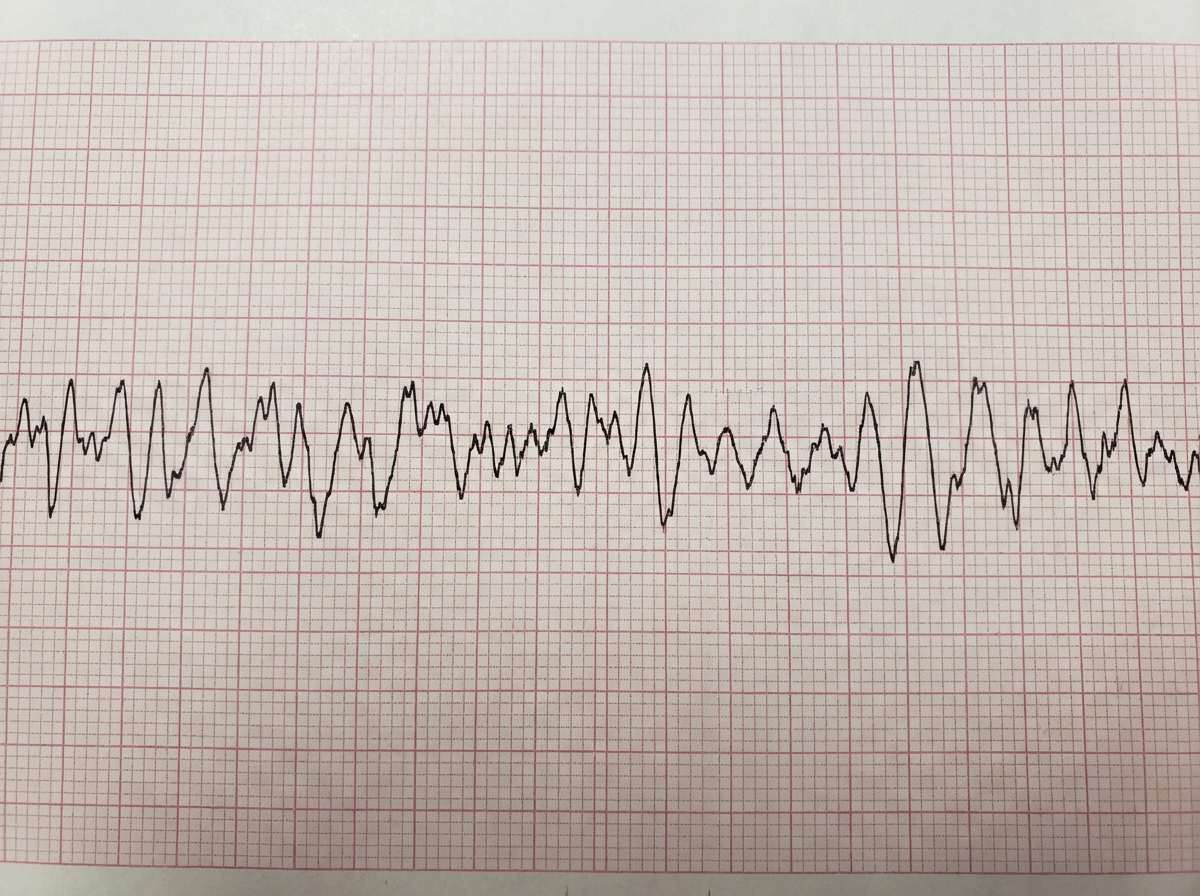 Image for question 354