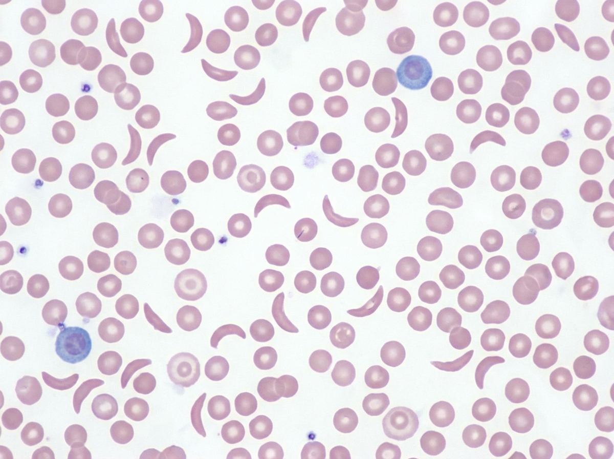 Image for question 701