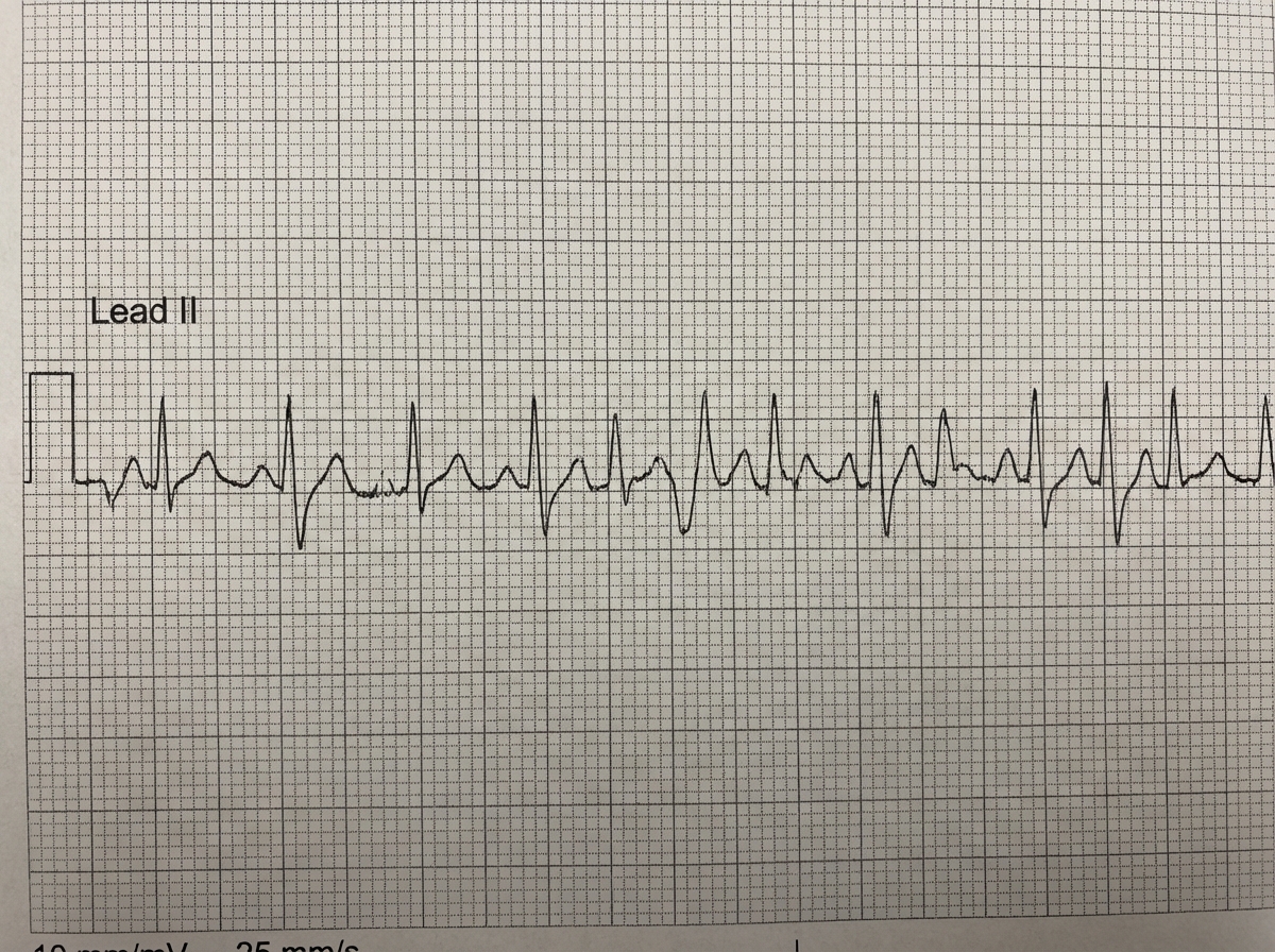 Image for question 342