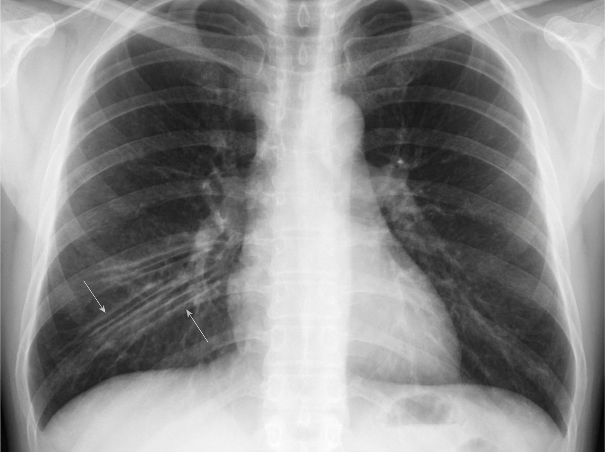 Image for question 166