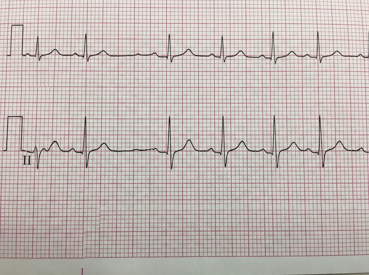 Image for question 1099