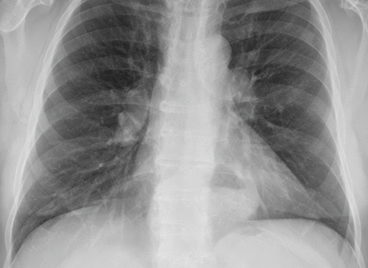 Image for question 533