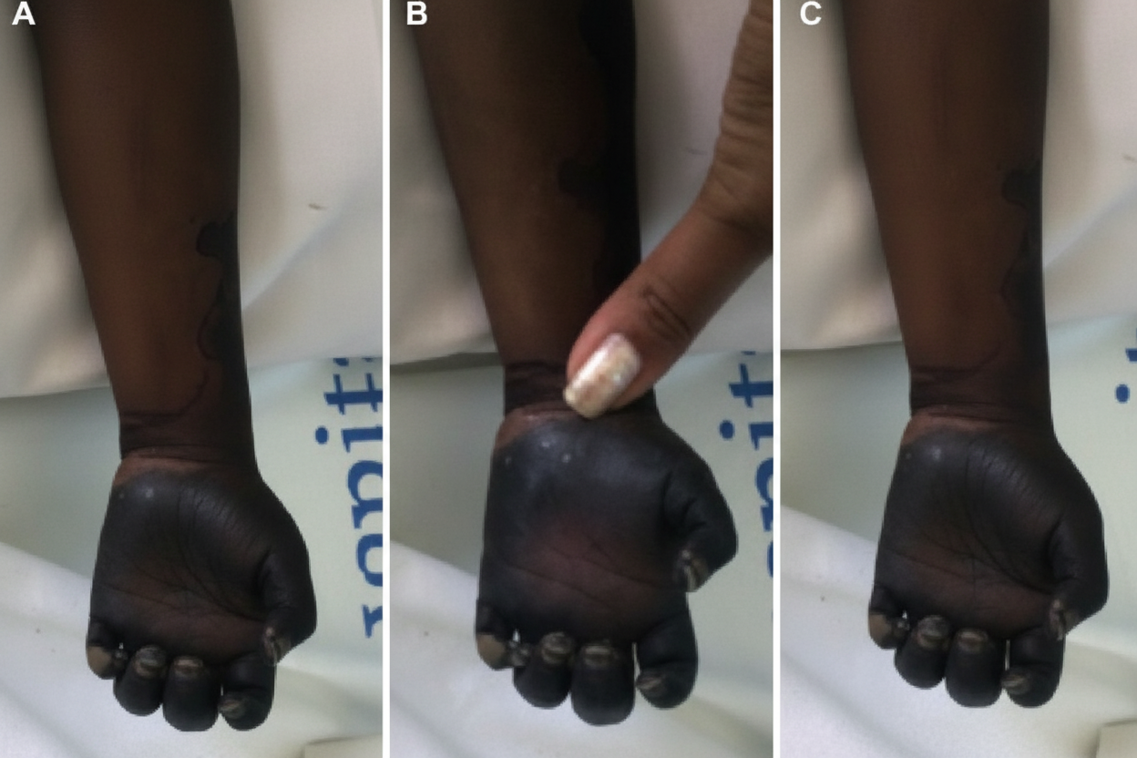 Image for question 386