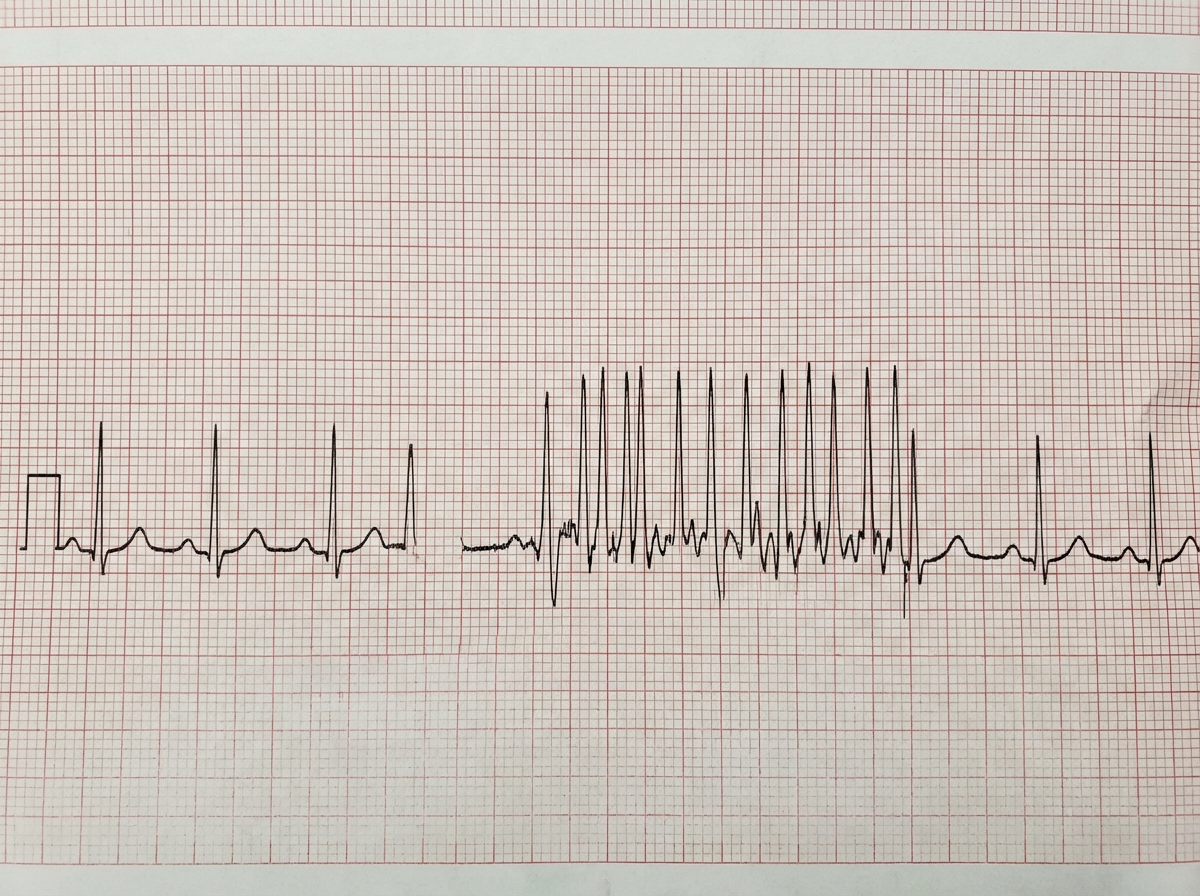 Image for question 262
