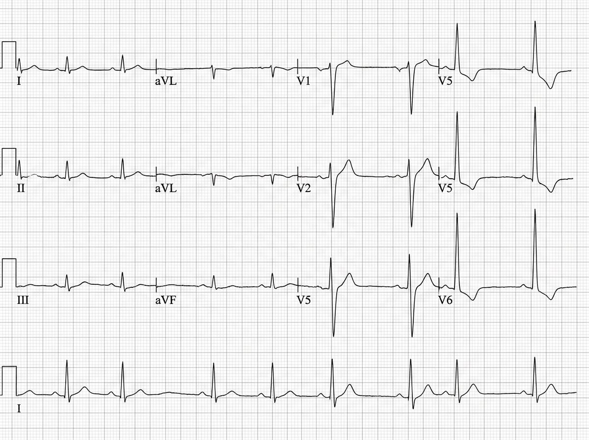 Image for question 20