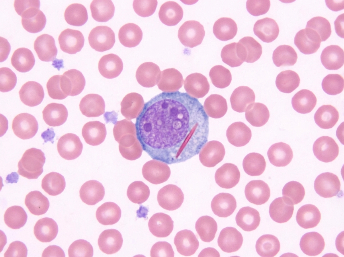 Image for question 14