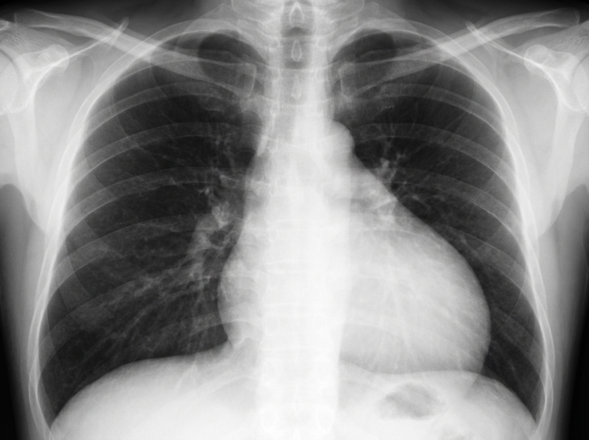 Image for question 111