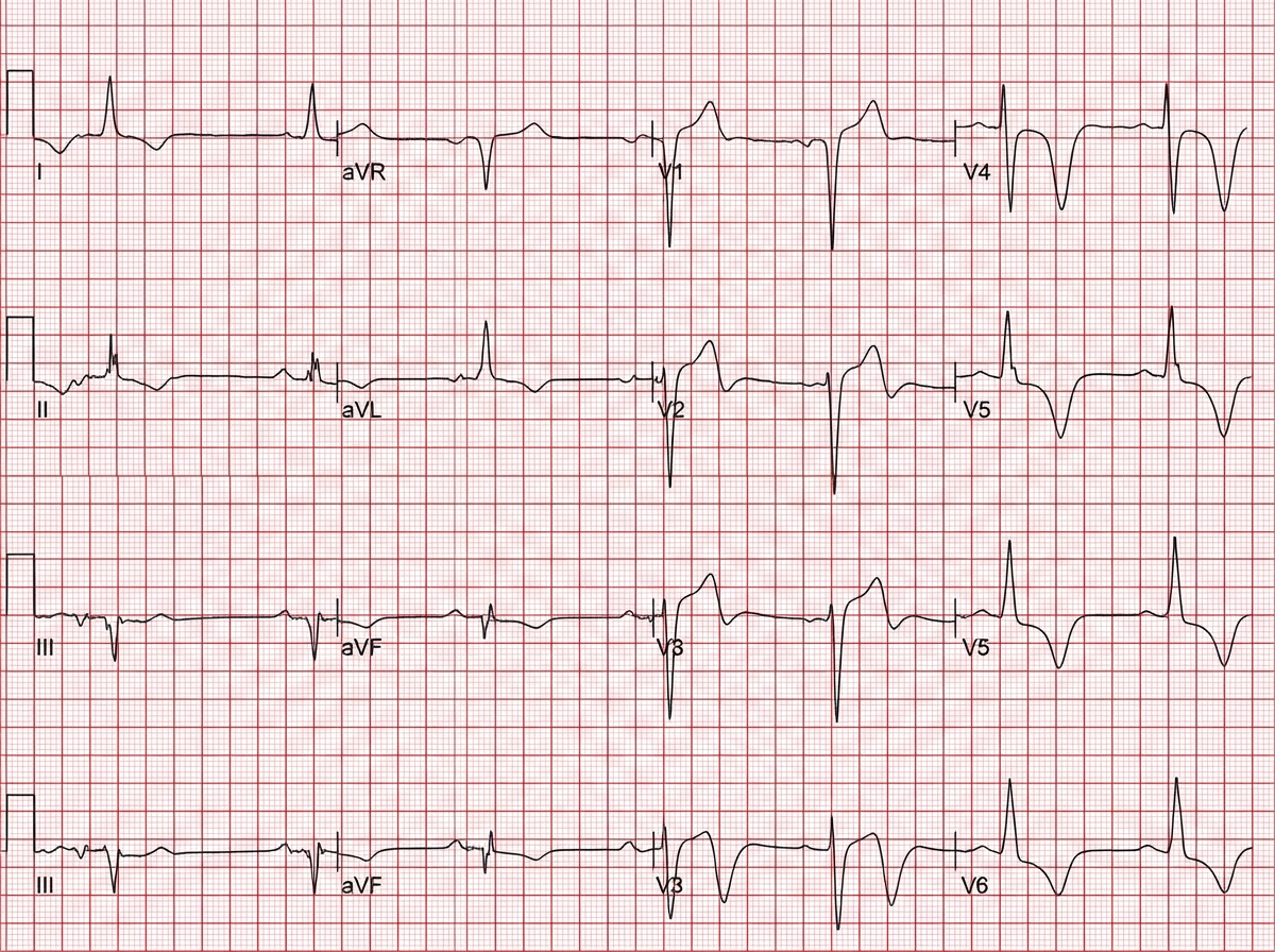 Image for question 209