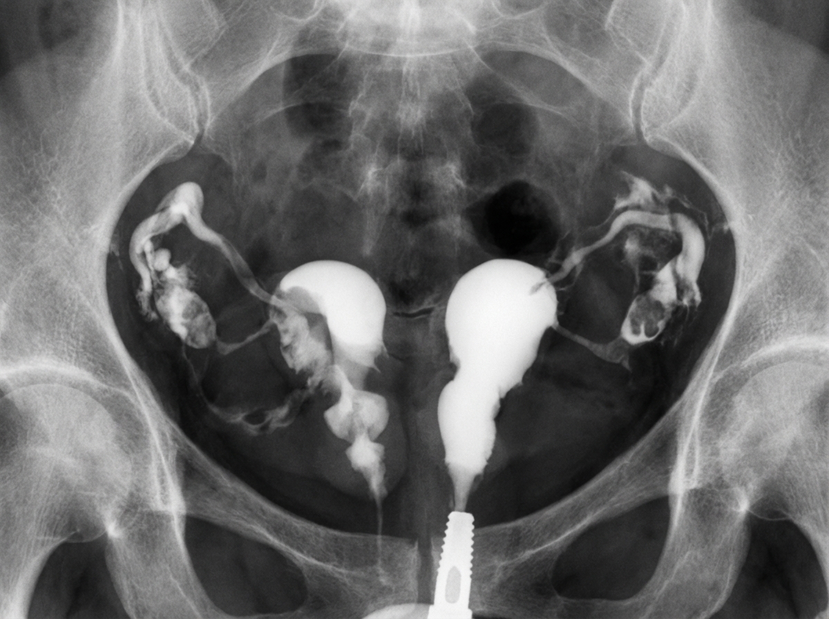 Image for question 537