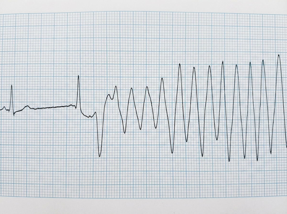 Image for question 2