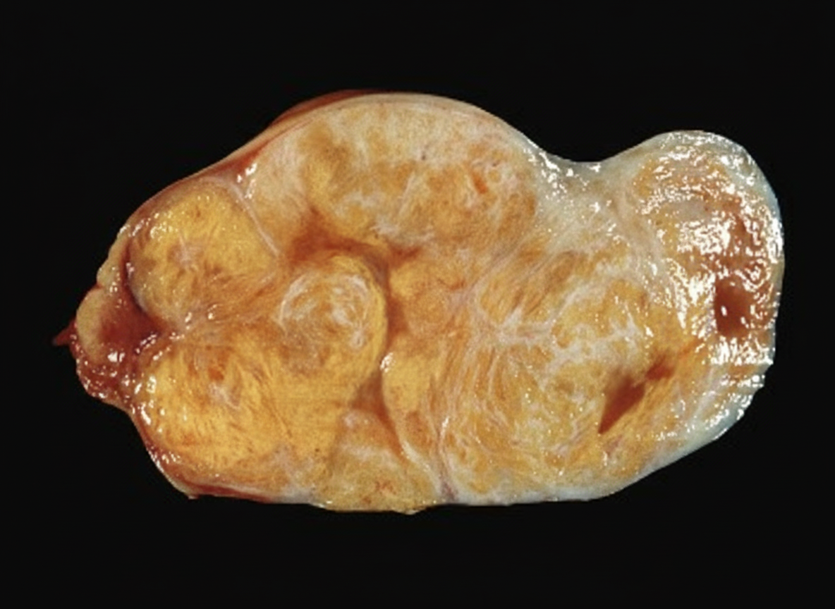 Image for question 219