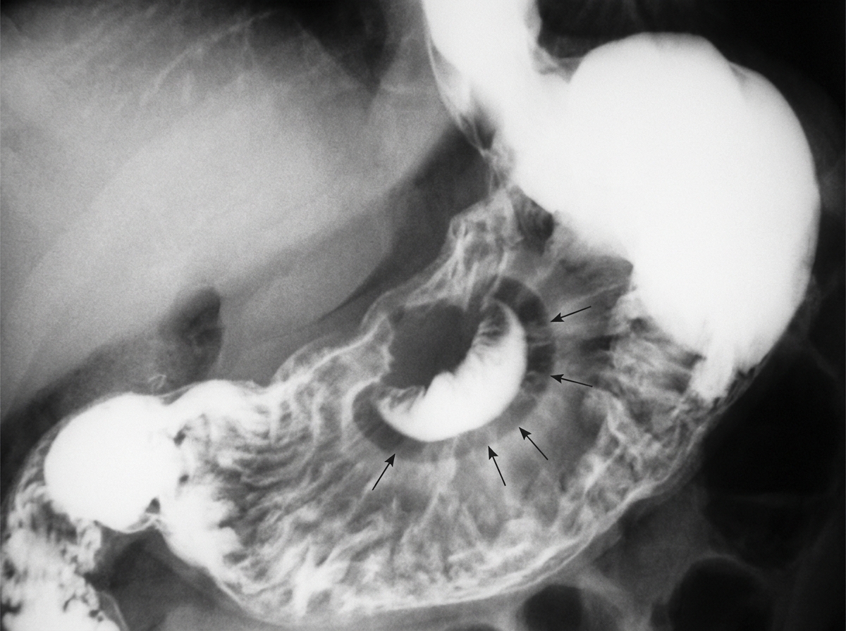 Image for question 15