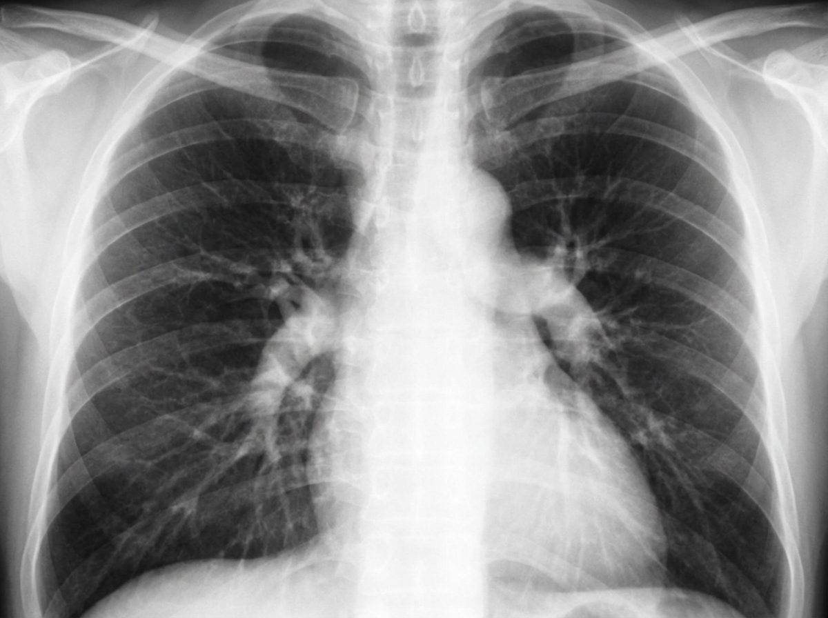 Image for question 42