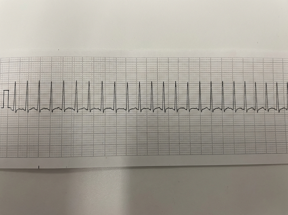 Image for question 34