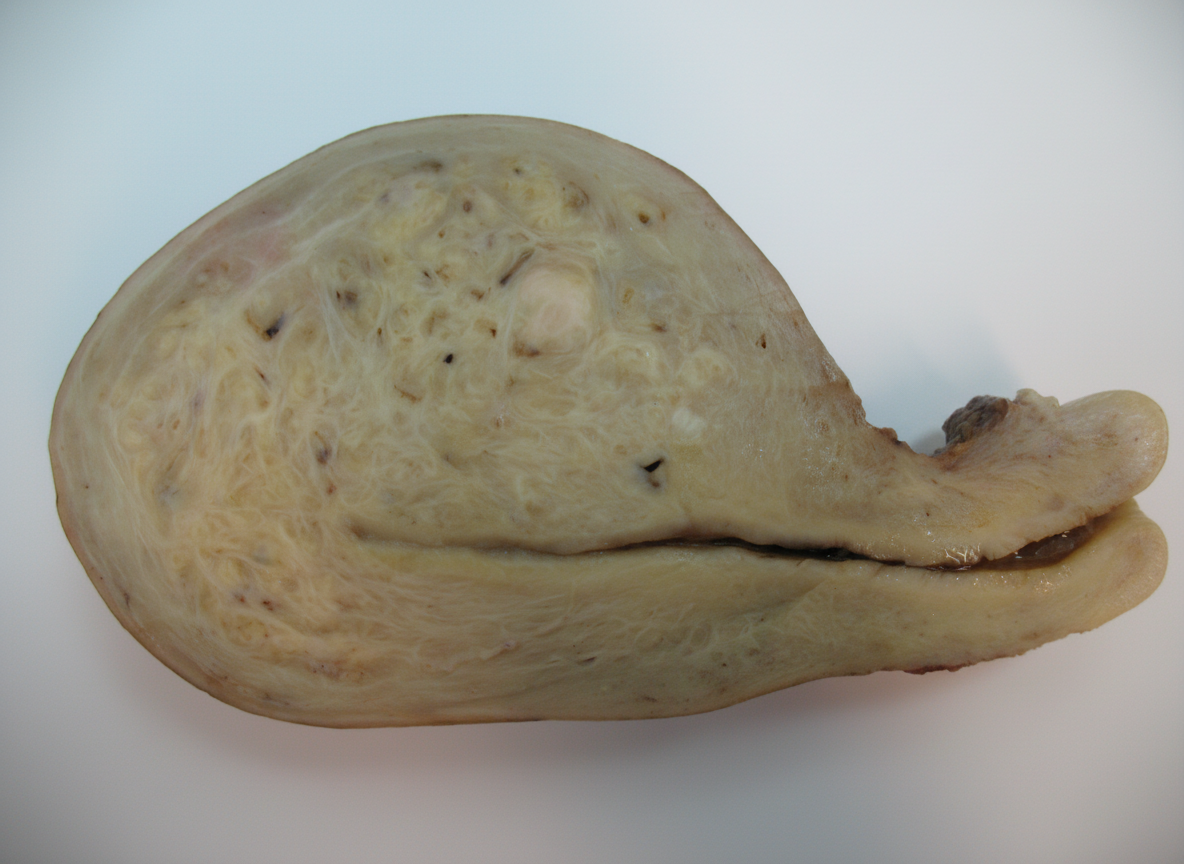 Image for question 392