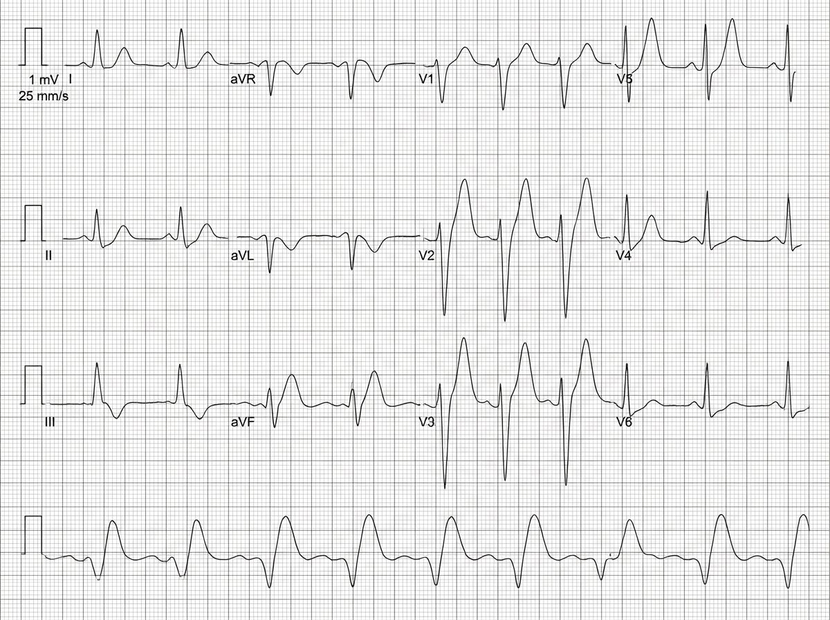 Image for question 746