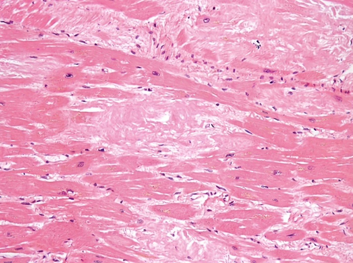 Image for question 113