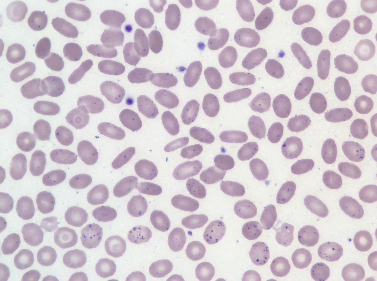 Image for question 104