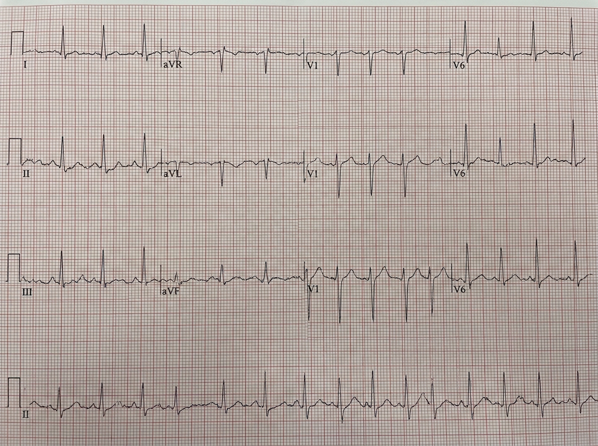 Image for question 5