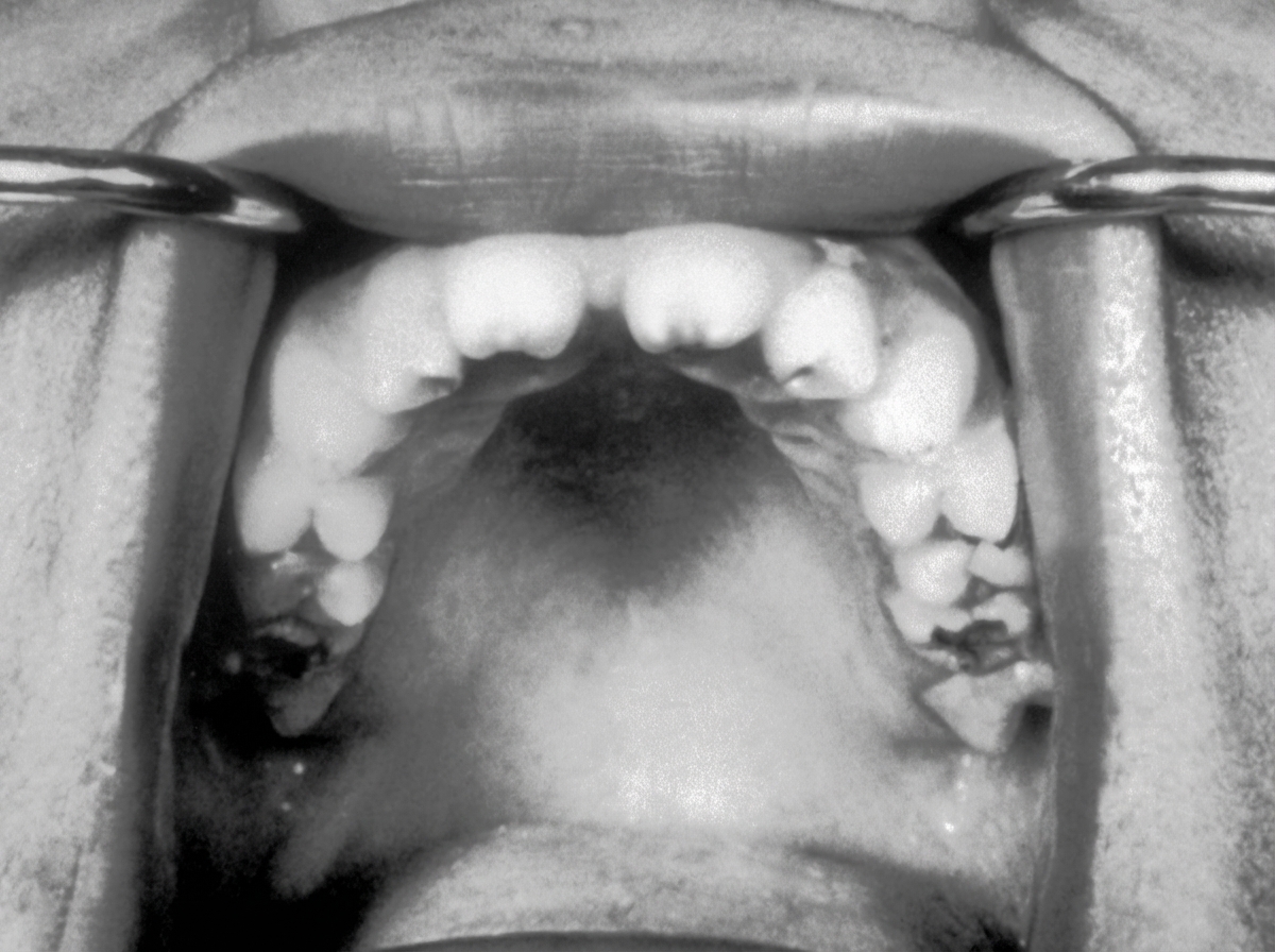 Image for question 327