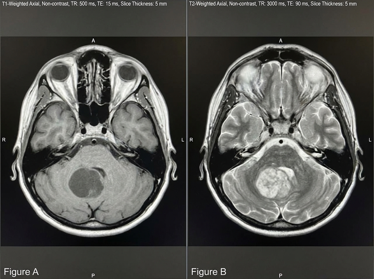 Image for question 256