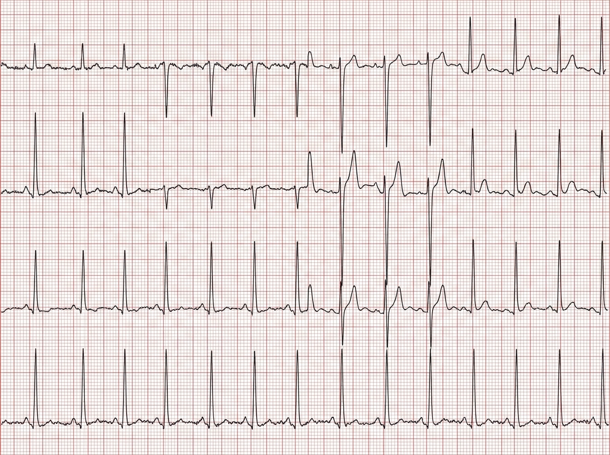 Image for question 17