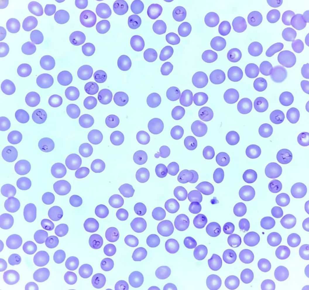 Image for question 730