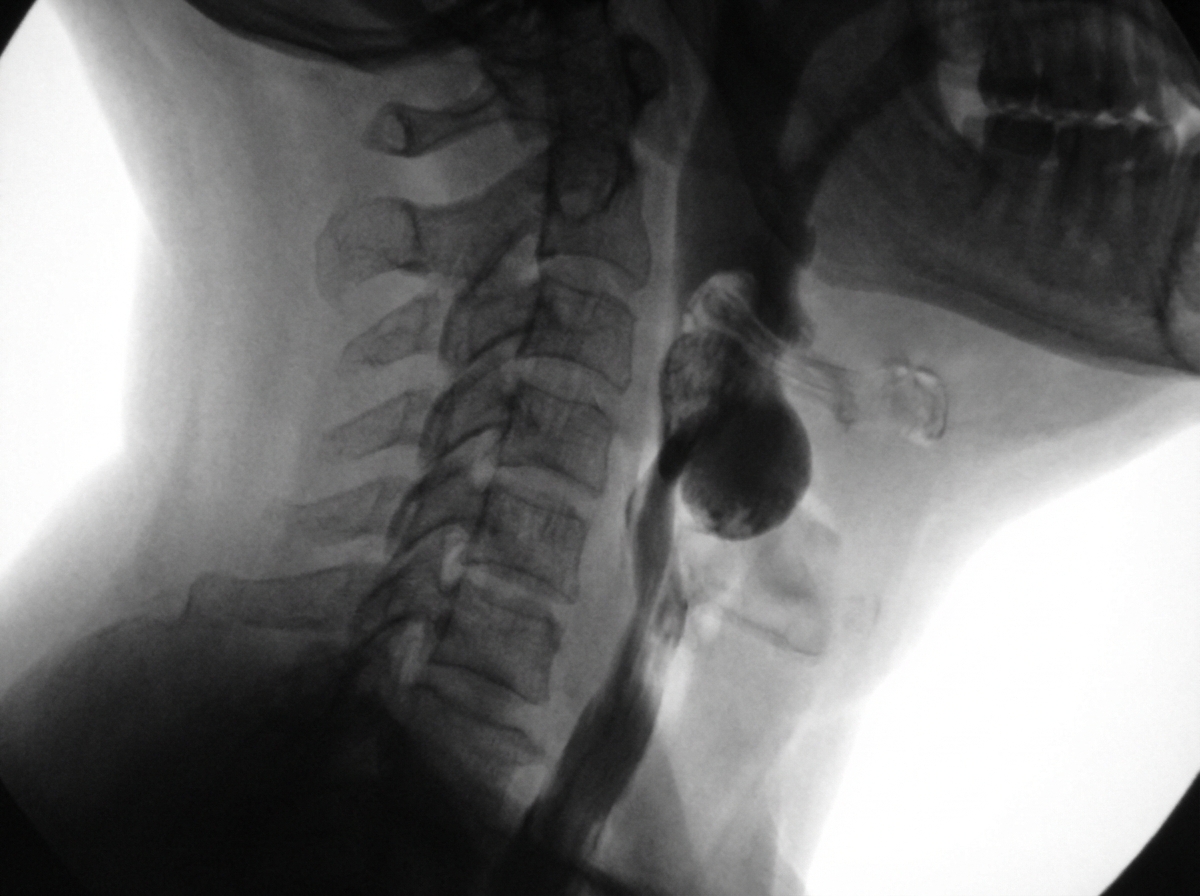 Image for question 493