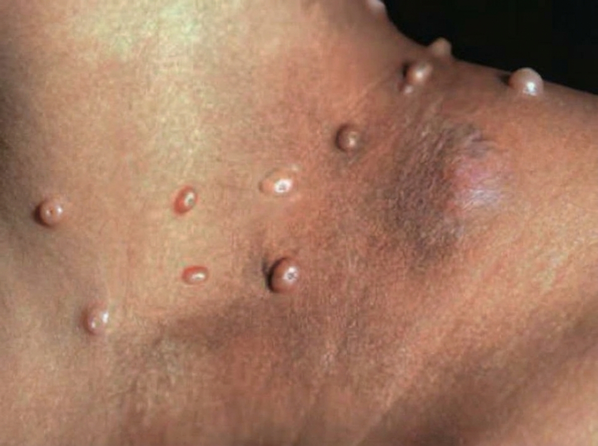 Image for question 52