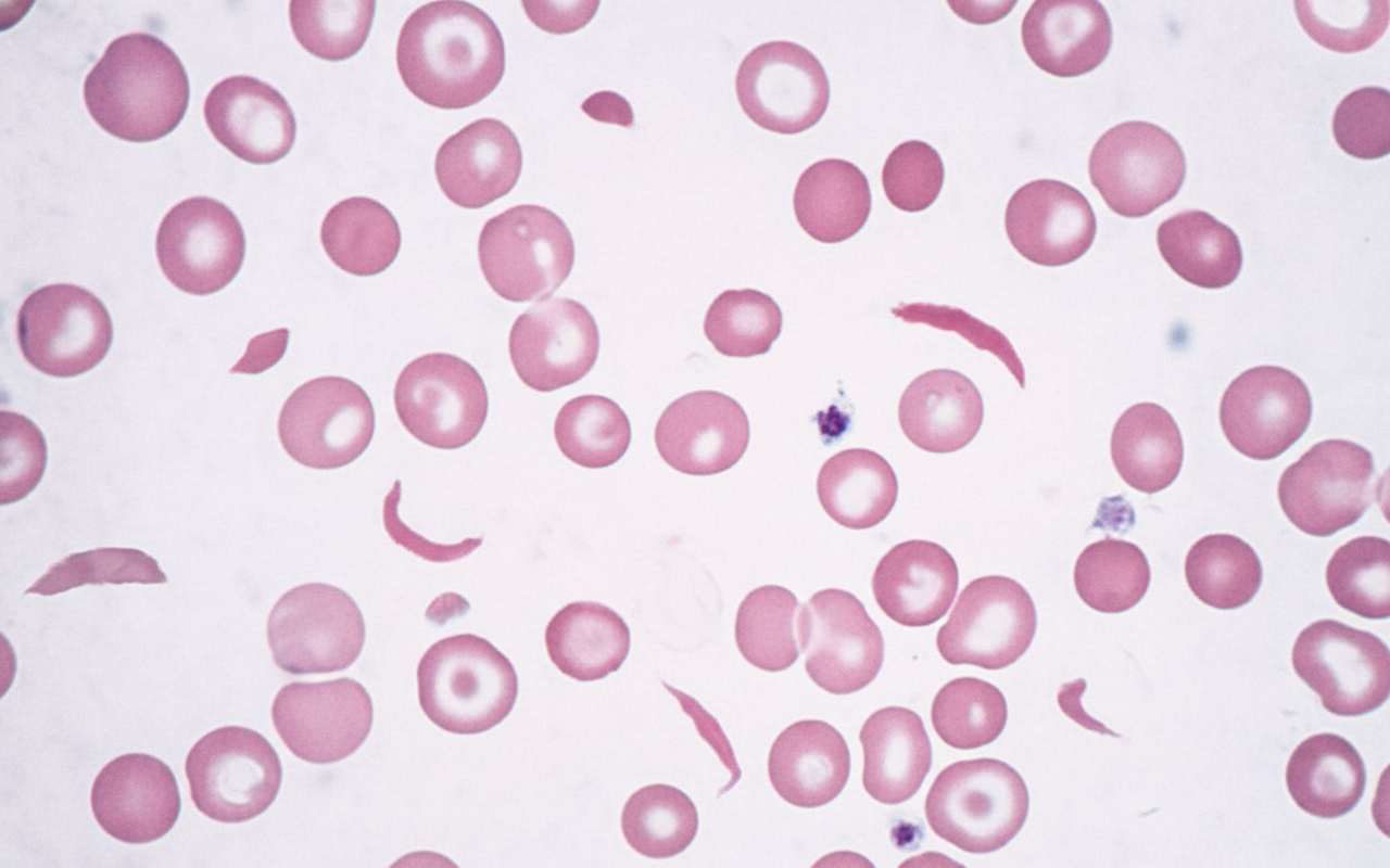 Image for question 92