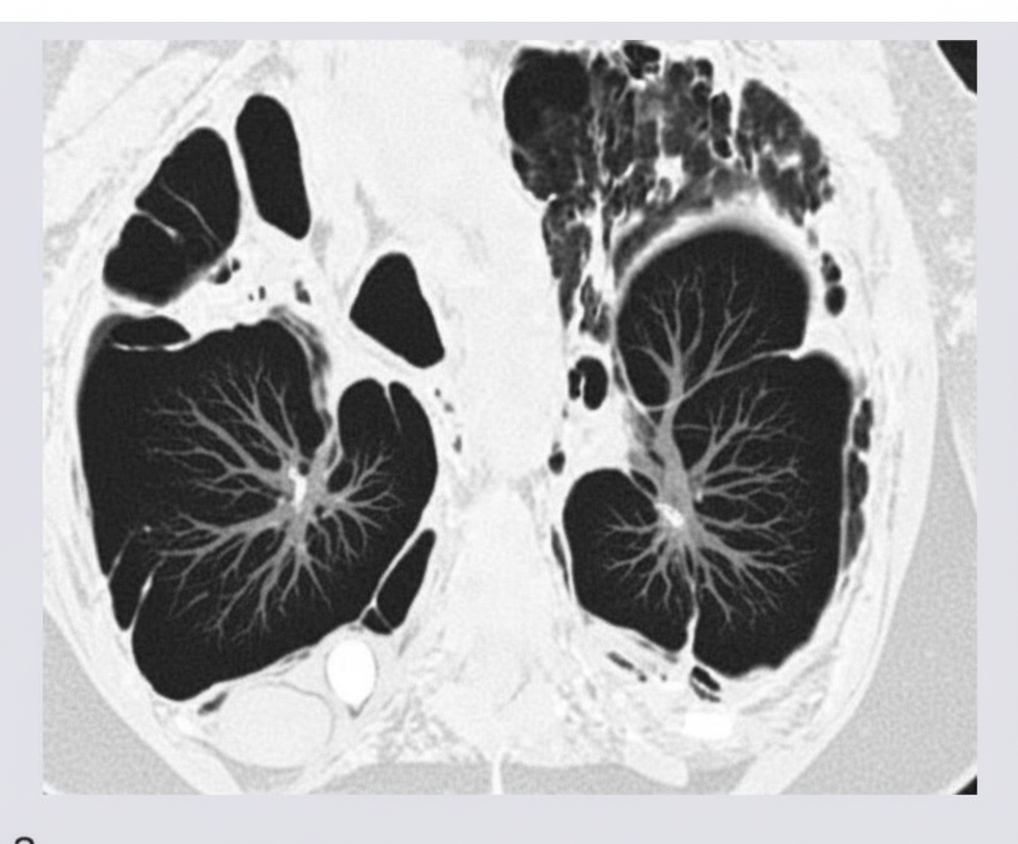 Image for question 136