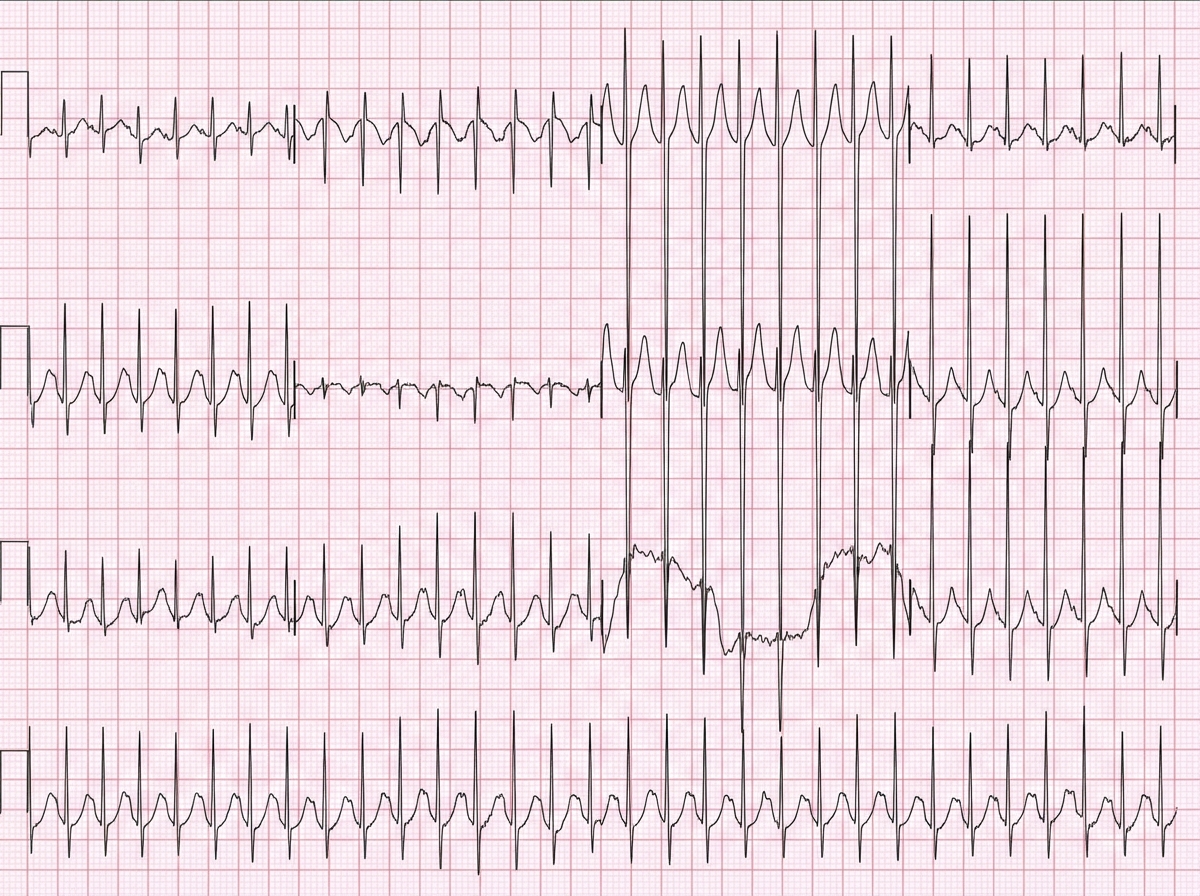Image for question 66