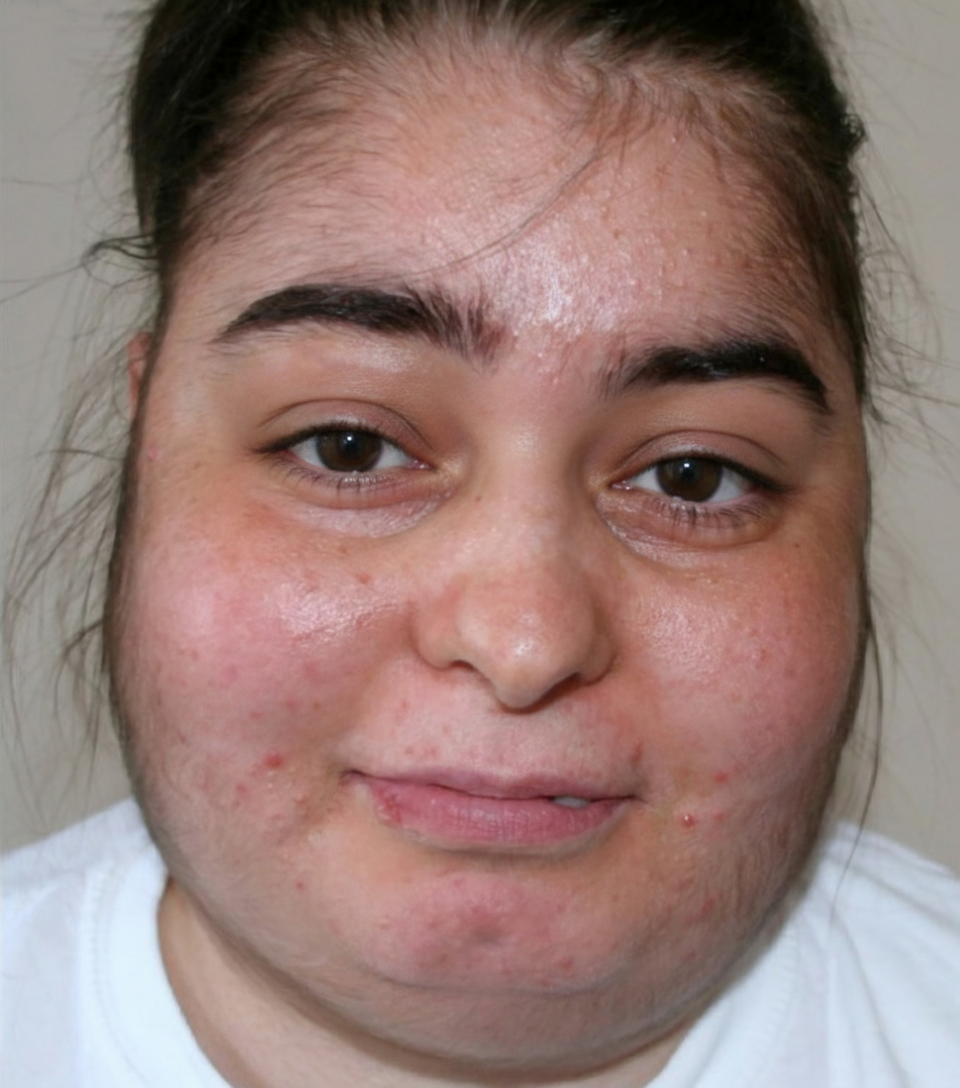 Image for question 1055