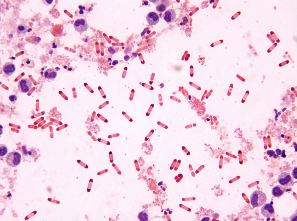 Image for question 234