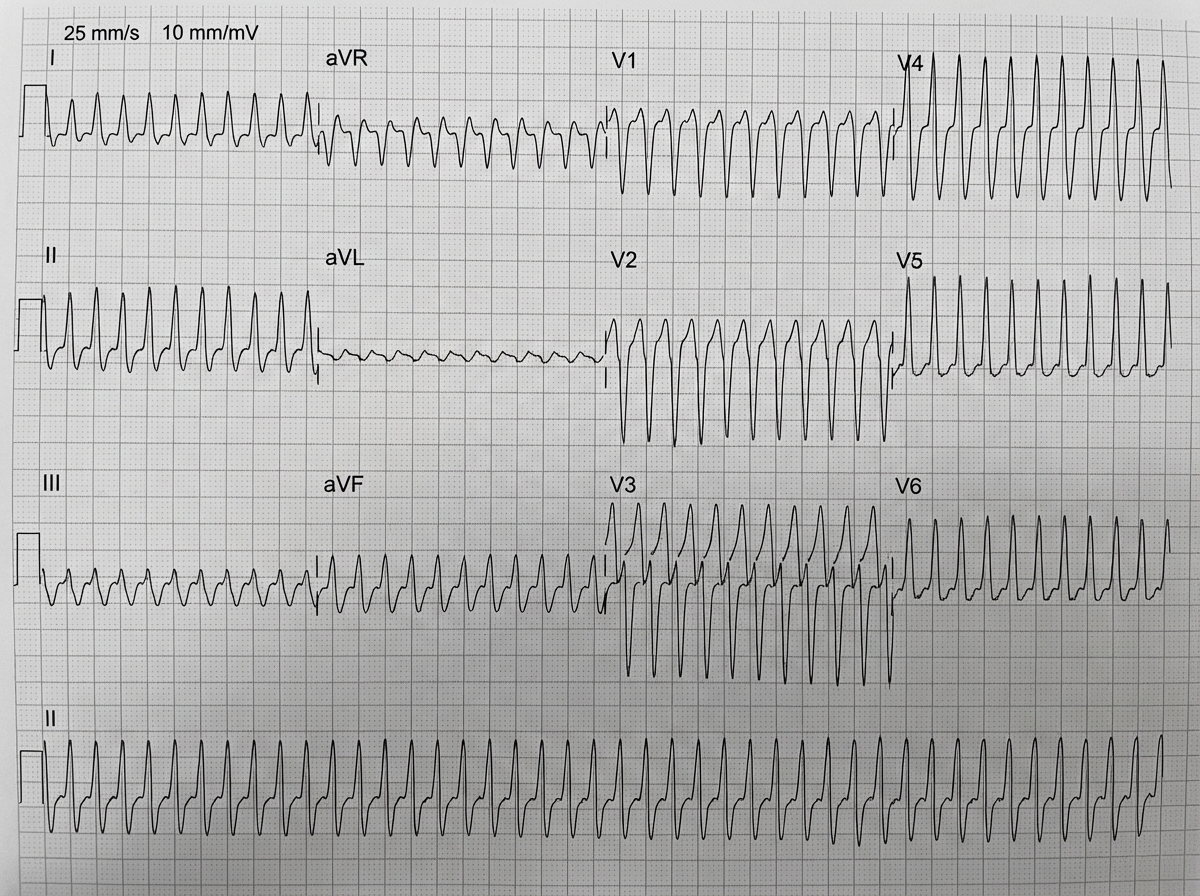 Image for question 1