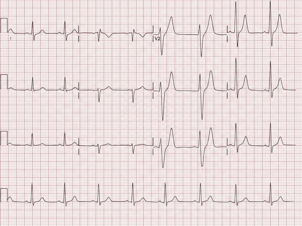 Image for question 5