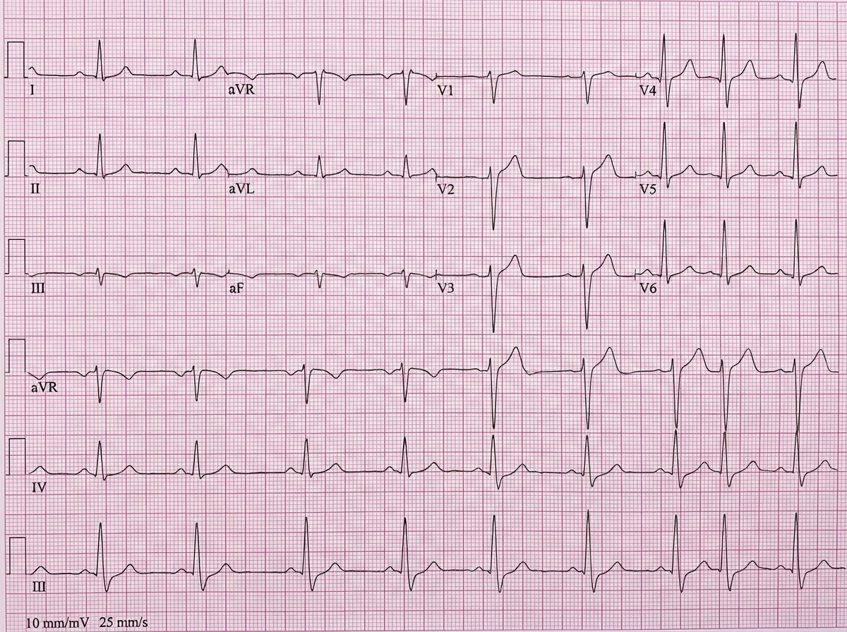 Image for question 943